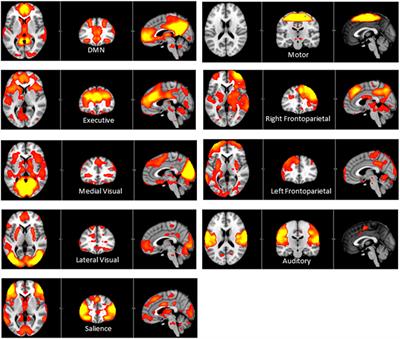 Reduced Resting-State Functional Connectivity in Current and Recovered Restrictive Anorexia Nervosa